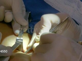 Aj lee dari wwe mendapat dia third payudara implant: gratis dewasa video 8e